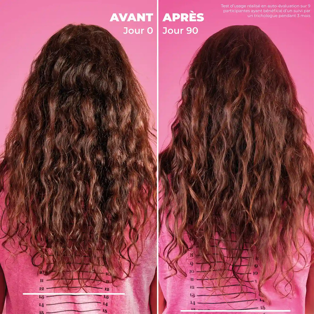 Duo Kurl Hero - Sérum anti-chute, croissance et densifiant & Dermaroller cuir chevelu