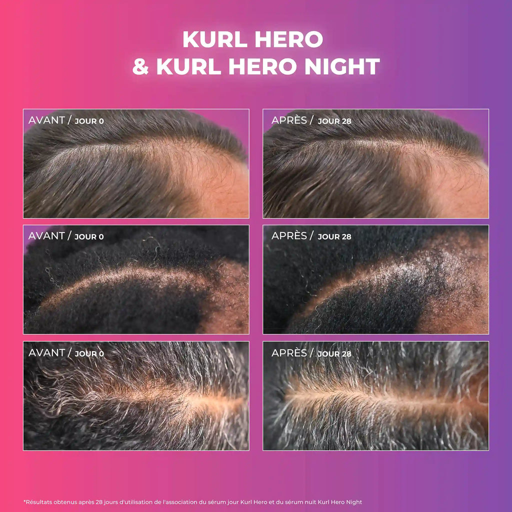 Kurl Hero Day & Night Duo - Fortifying Day Serum + Repairing Night Serum