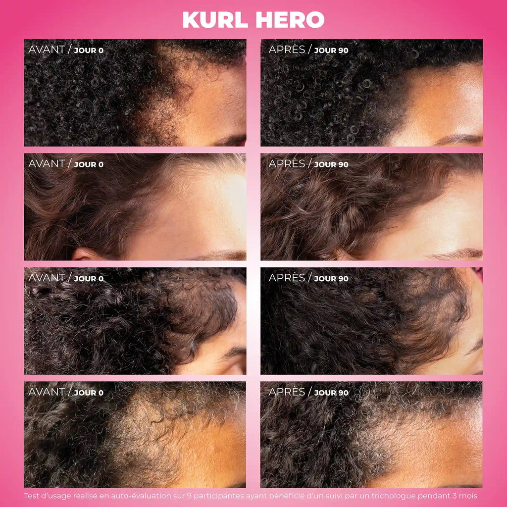 Duo Kurl Hero - Sérum anti-chute, croissance et densifiant & Dermaroller cuir chevelu